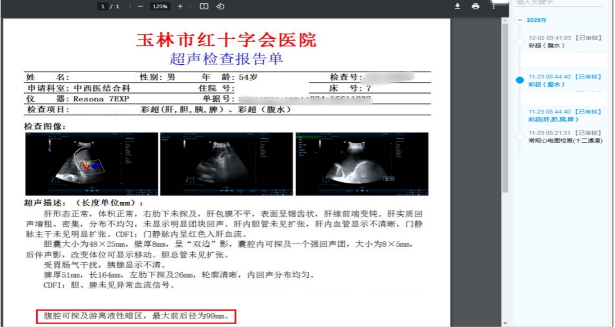 【健康科普】腹水明显减少！一份超声报告，看中西医结合诊疗过程