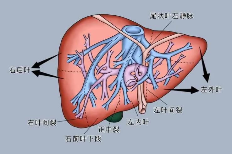 【医疗技术】双导航精准定位 微创根治早癌——玉林市红十字会医院成功开展ICG荧光联合术中B超腹腔镜肝右前叶切除术