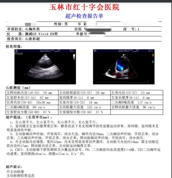 【医疗技术】玉林市红十字会医院完成高难度升主动脉置换联合冠脉搭桥手术