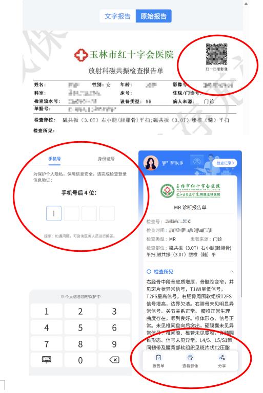 【便民新举措】“云影像”上线  影像报告随时随地查