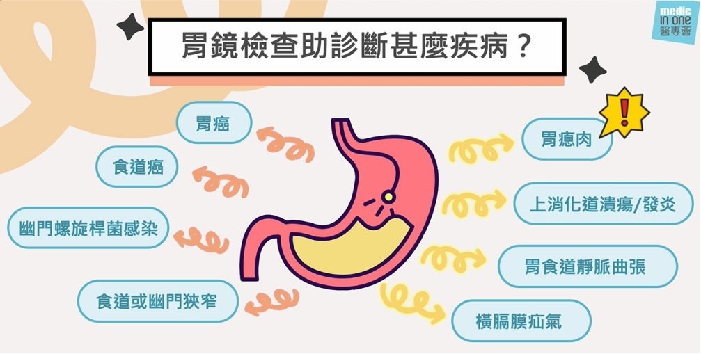 【肿瘤防治】守护“胃”来，从早筛早防开始