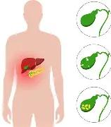 【健康科普】胆囊炎与饮食调理：解锁健康饮食的“关键钥匙”